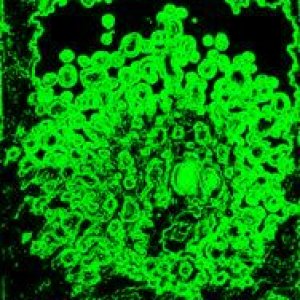 album Mood Disorders EP - VerdeIride