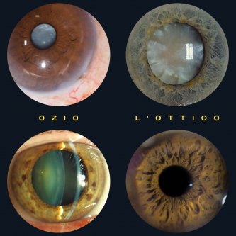 Ozio