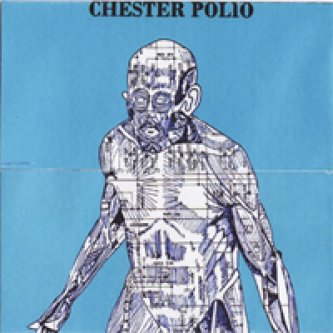 Copertina dell'album Chester Polio, di Chester Polio